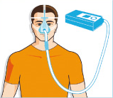CPAP
